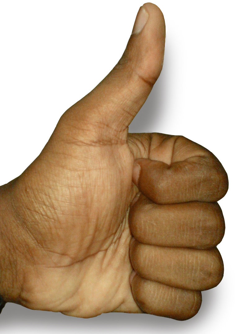 The_Thumbs-up_position
